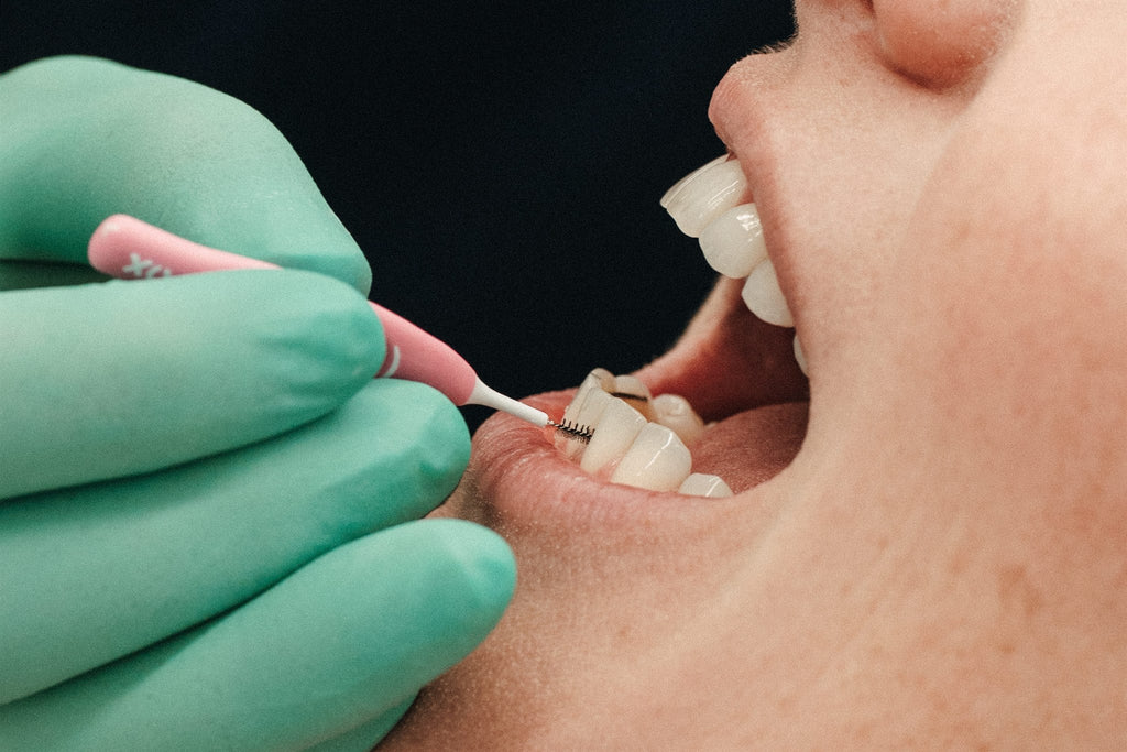 Professioneel bleken - Image 3