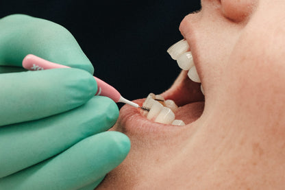 Professioneel bleken