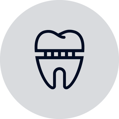 Kronen, bruggen en facings